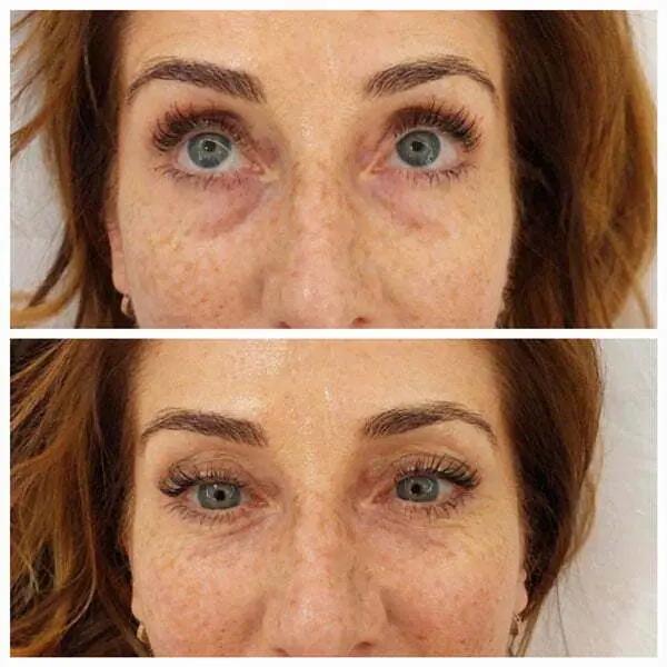 Crema Anti - ojeras Aurea Lab. Reduce tus ojeras en 7 días - Aurea Lab