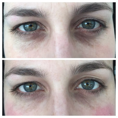 Crema Anti-ojeras Dr Retinol. Elimina tus ojeras en 7 días