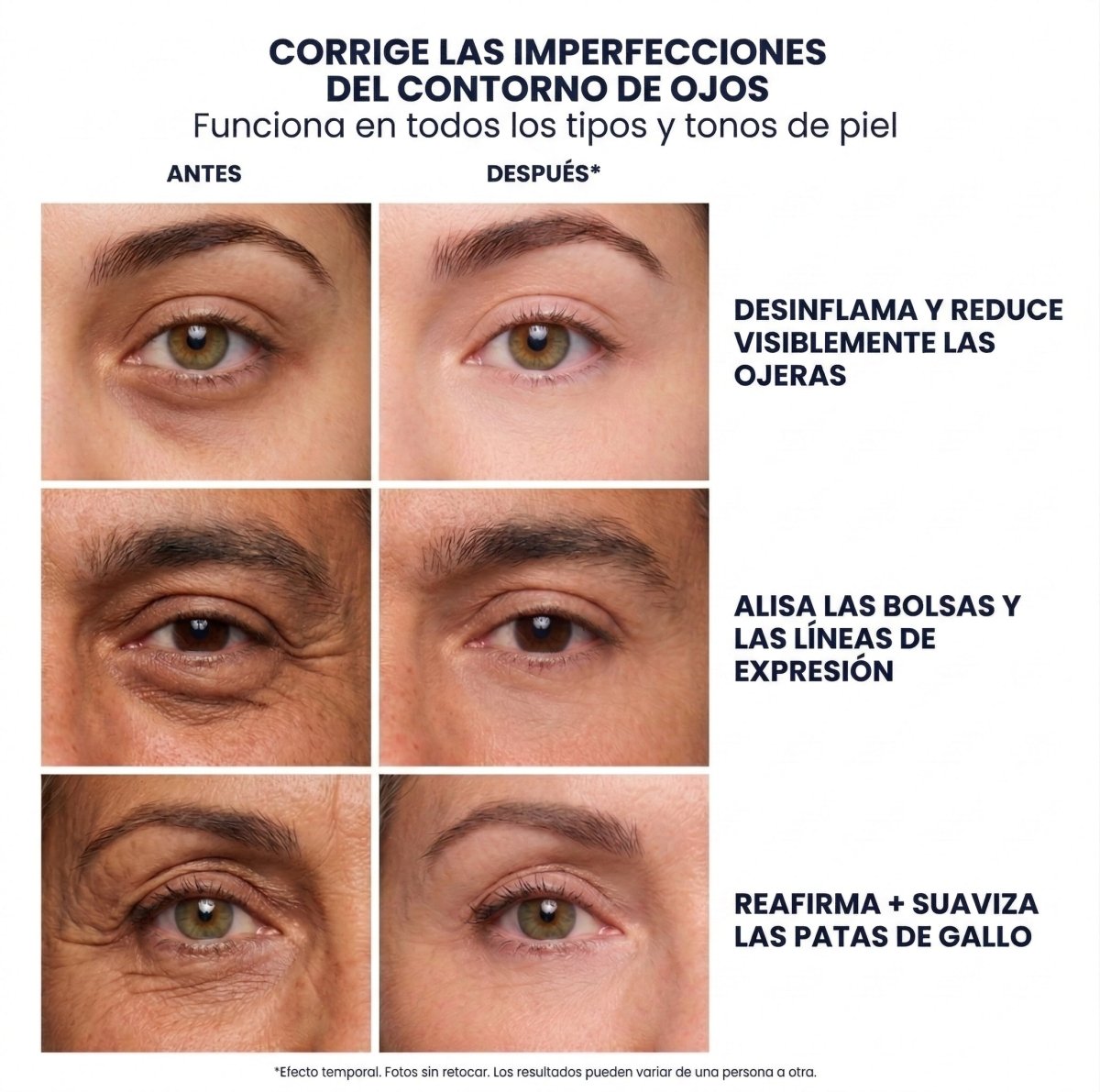 Crema Anti - ojeras Aurea Lab. Reduce tus ojeras en 7 días. - Aurea Lab