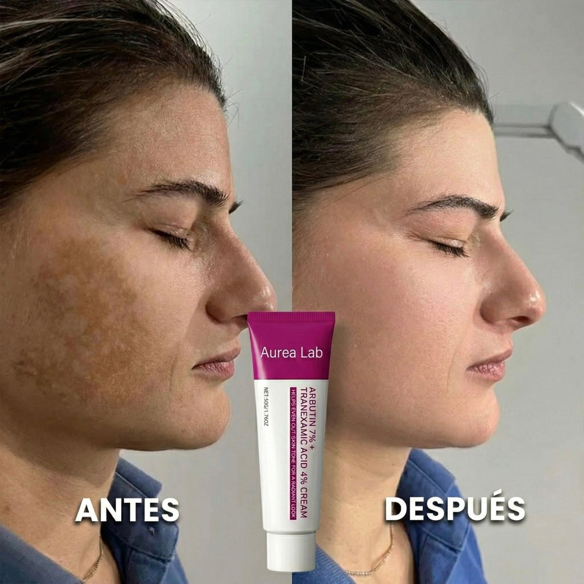 Bálsamo Anti Melasma. Reduce manchas en 7 días - Aurea Lab