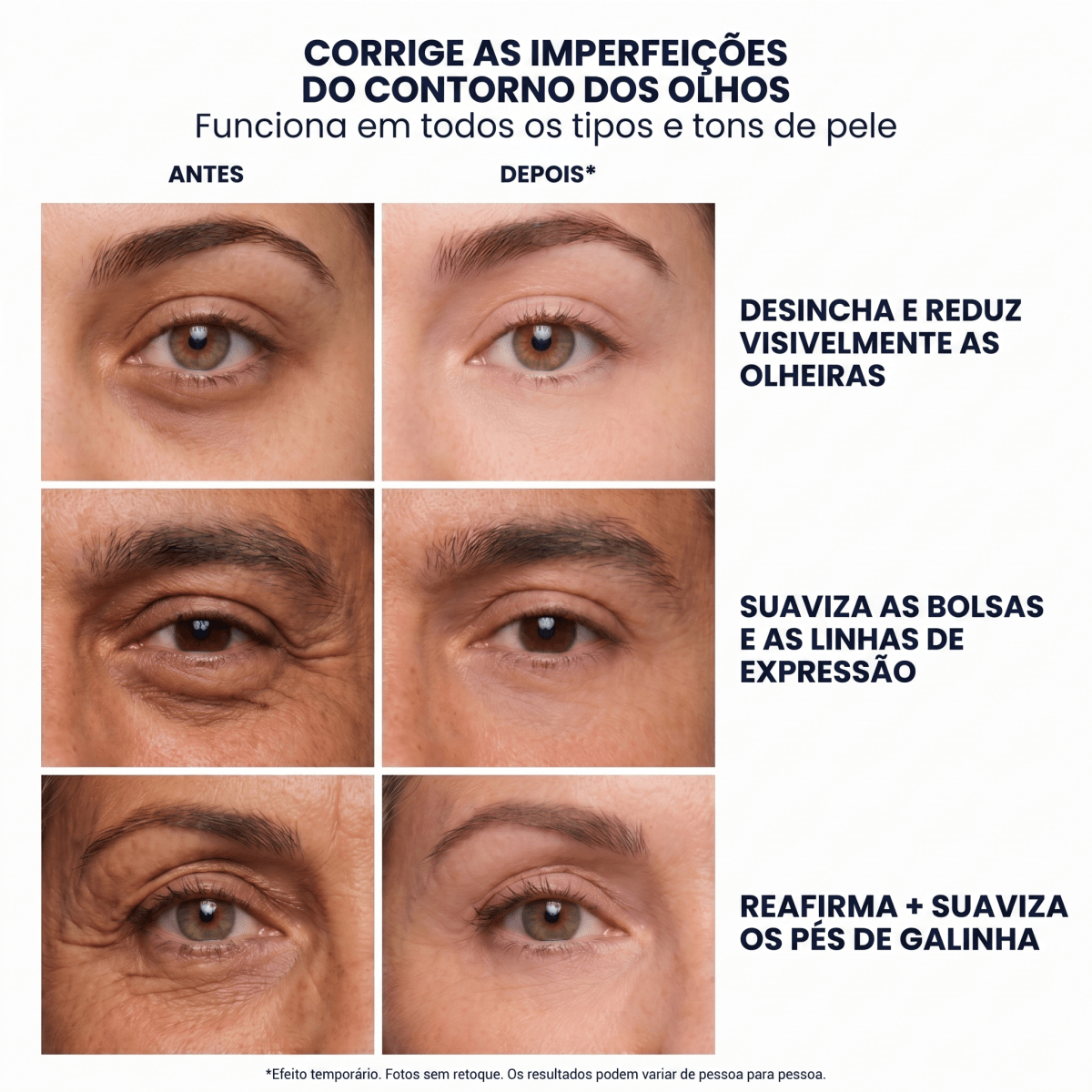 Anti-Olheiras - corrige o contorno dos olhos