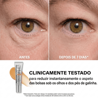 Anti-Olheiras - depois de 7 dias