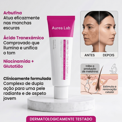 Melasma - clinicamente testado